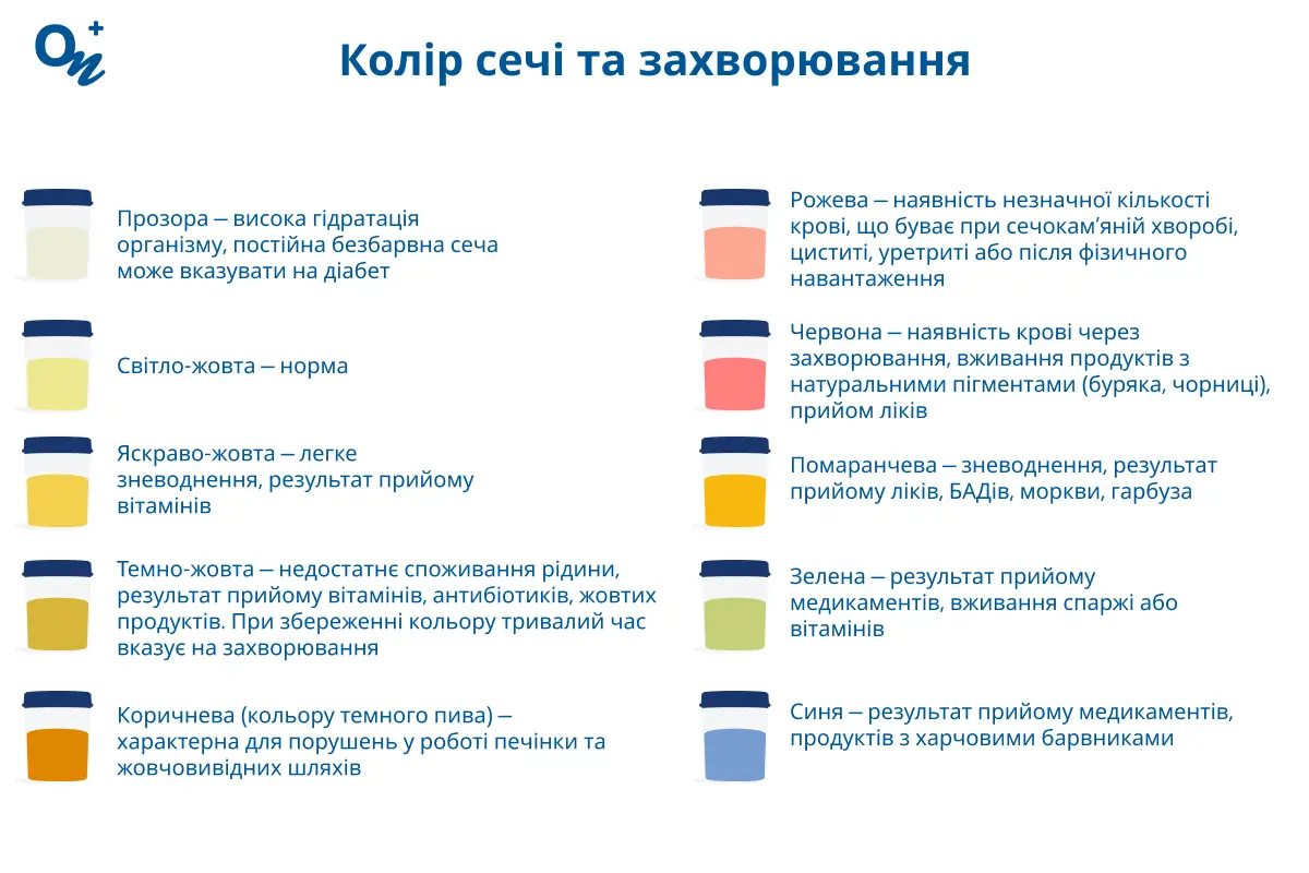 Колір сечі та захворювання