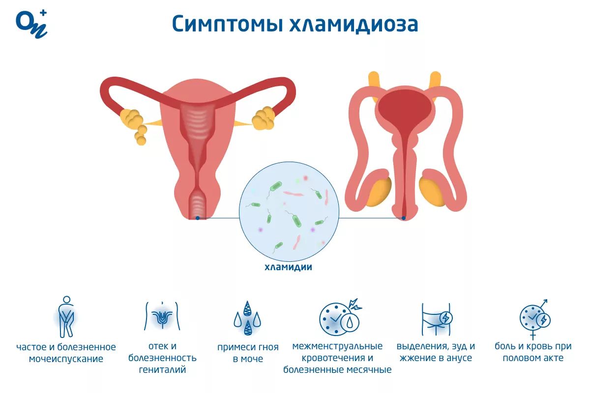 Хламидиоз - хламидийная инфекция - признаки, симптомы, диагностика и лечение хламидиоза