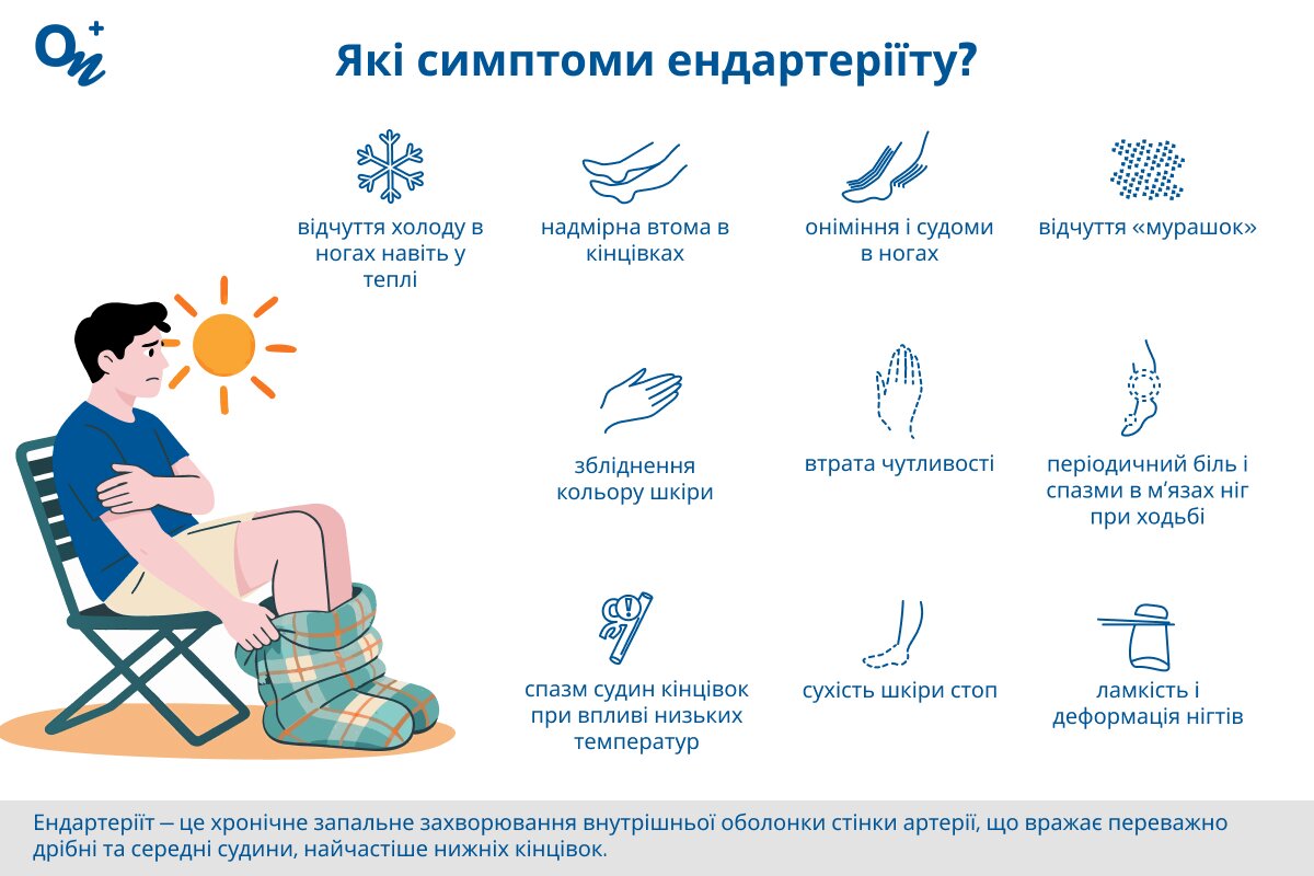 Які симптоми ендартеріїту?