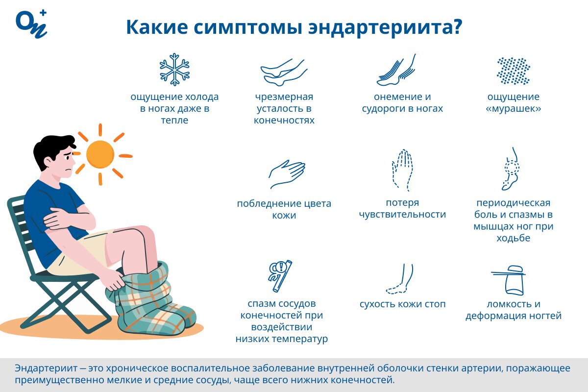 Какие симптомы эндартериита?