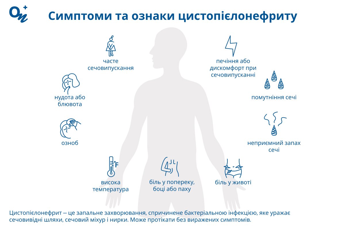 Які симптоми цистопієлонефриту?