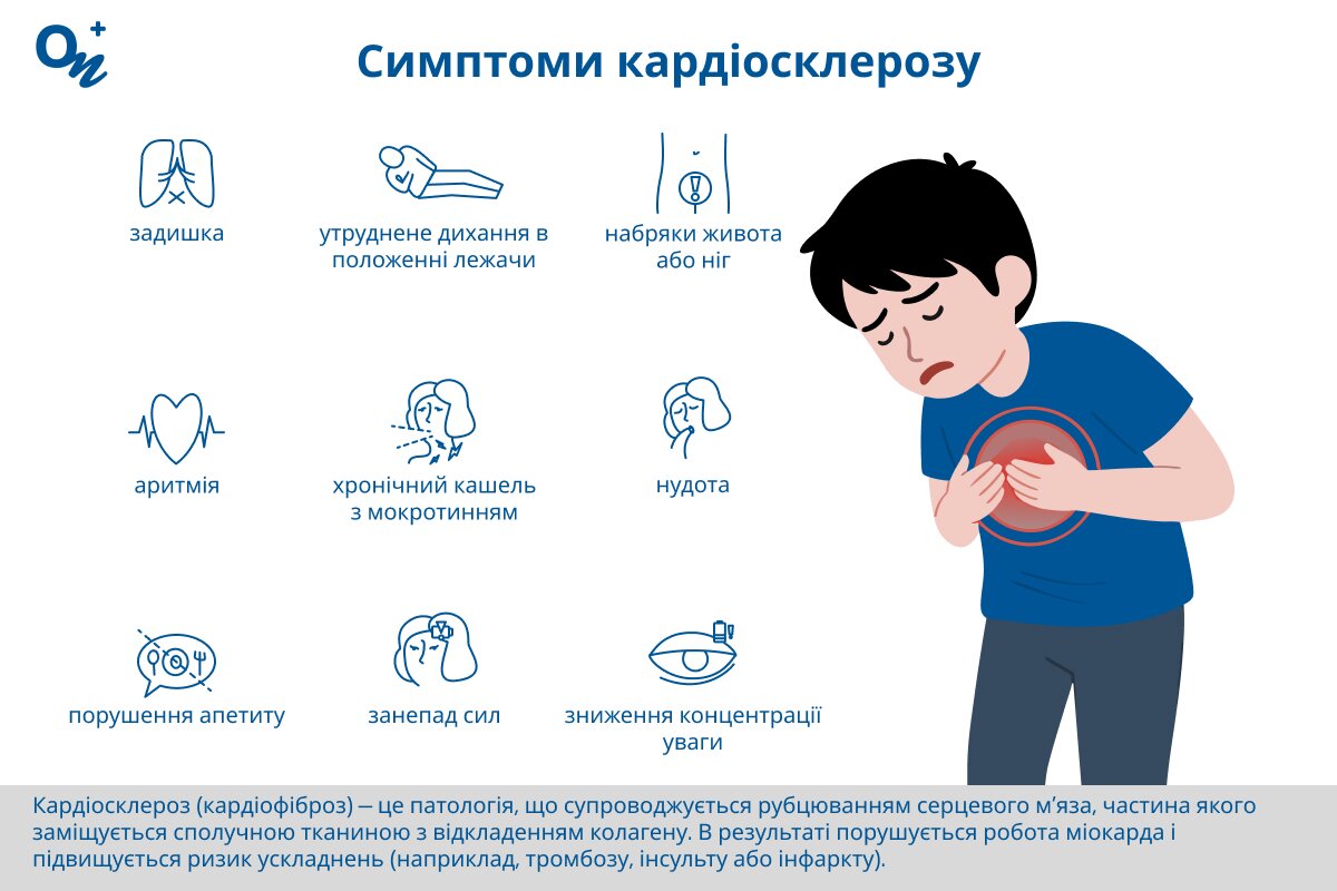 Які симптоми при каріосклерозі?
