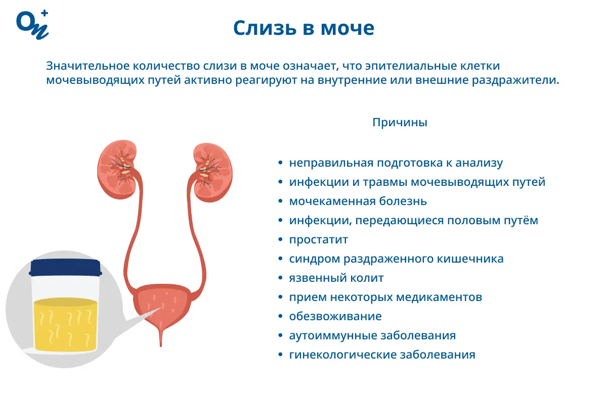 Слизь в моче