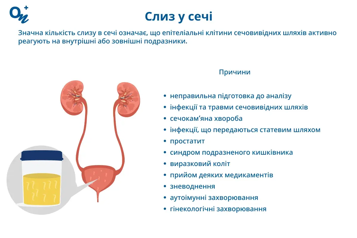 Слиз у сечі