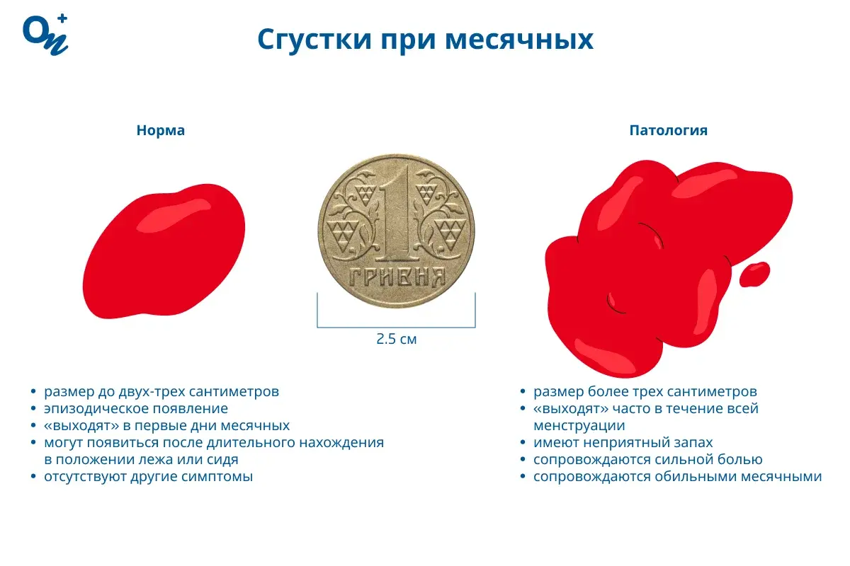 Сгустки при месячных