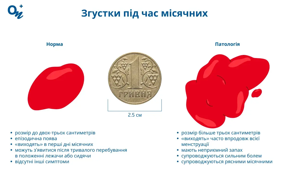 Згустки під час місячних