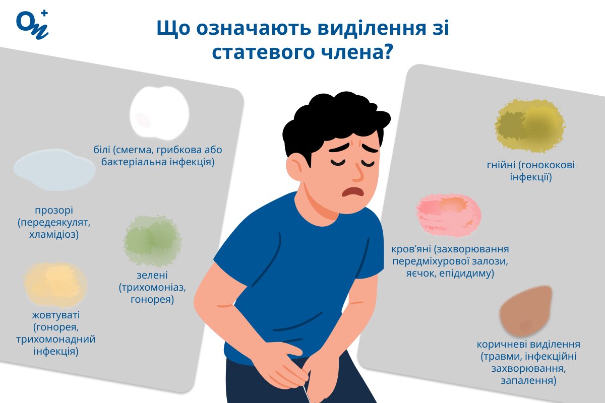 Що означають виділення із статевого члена?