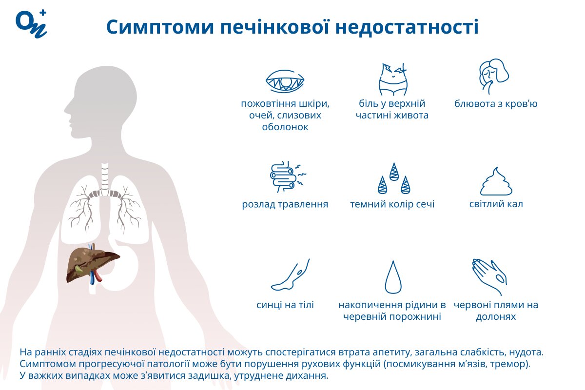 Ознаки печінкової недостатності