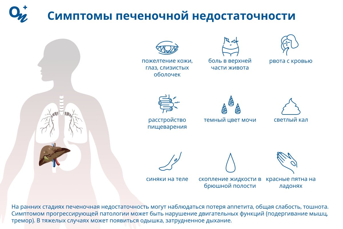 Признаки печеночной недостаточности