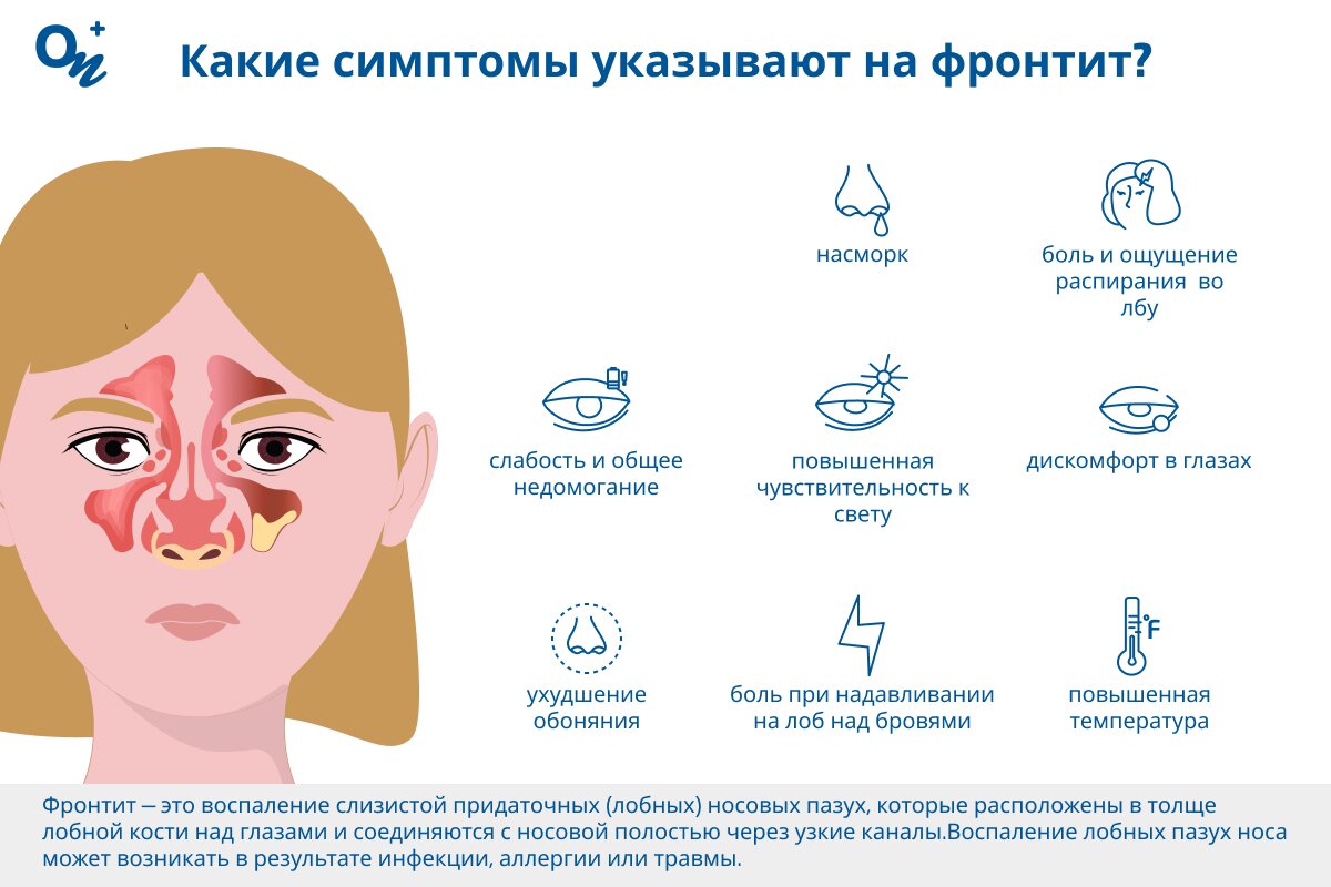 Какие симптомы при фронтите?