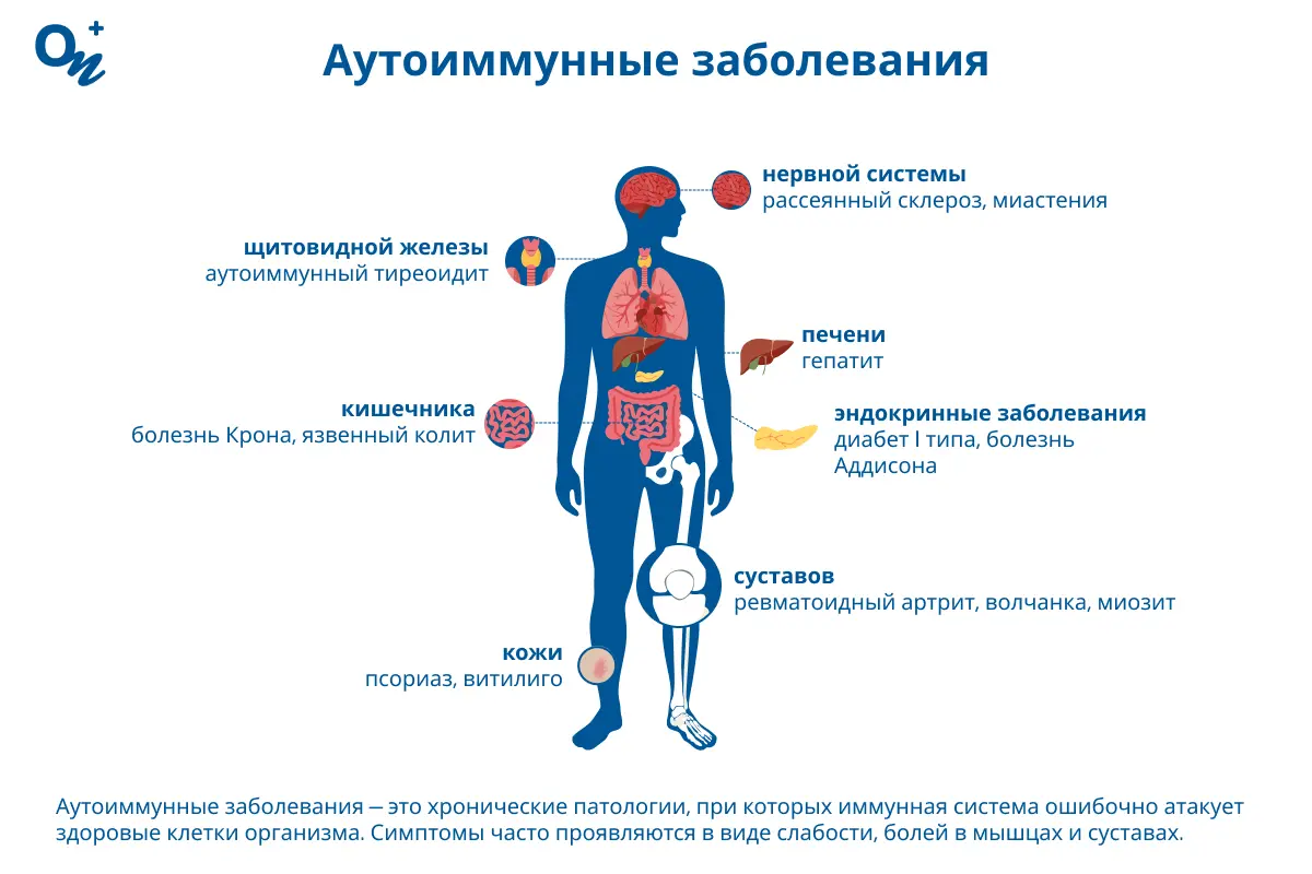 Аутоиммунные заболевания