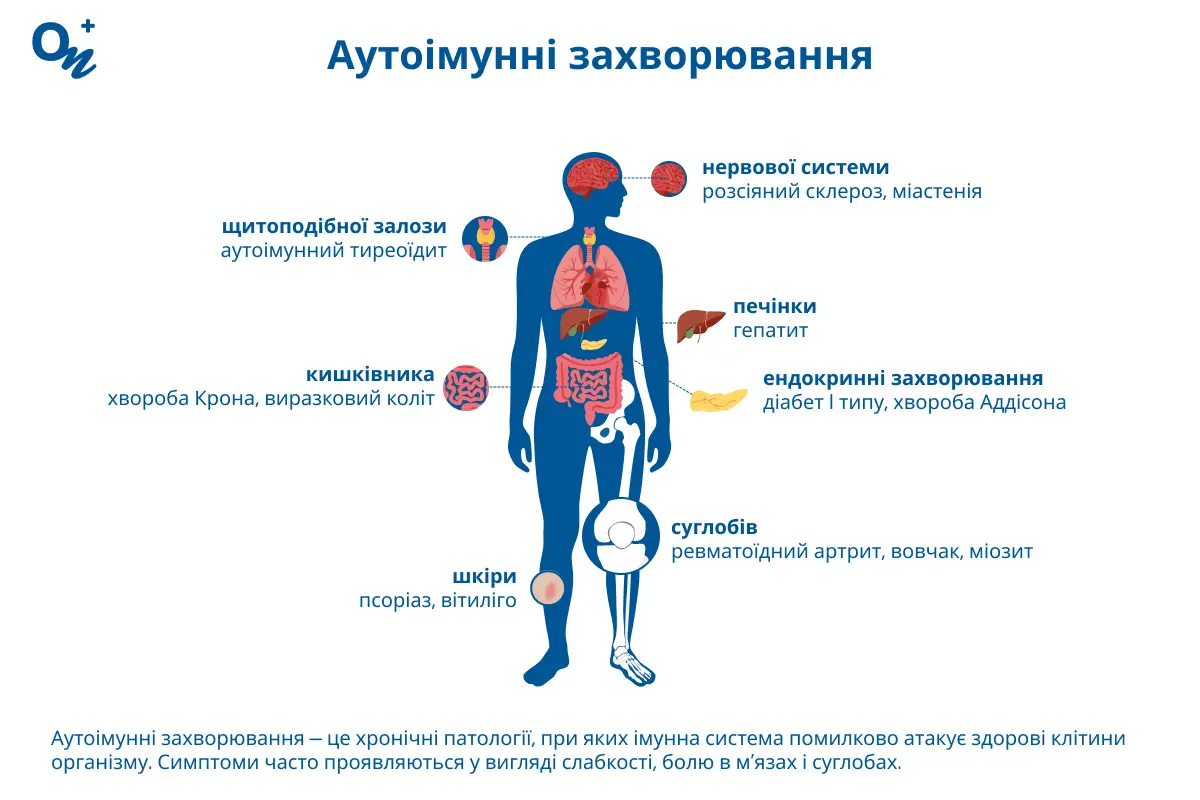 Аутоімунні захворювання