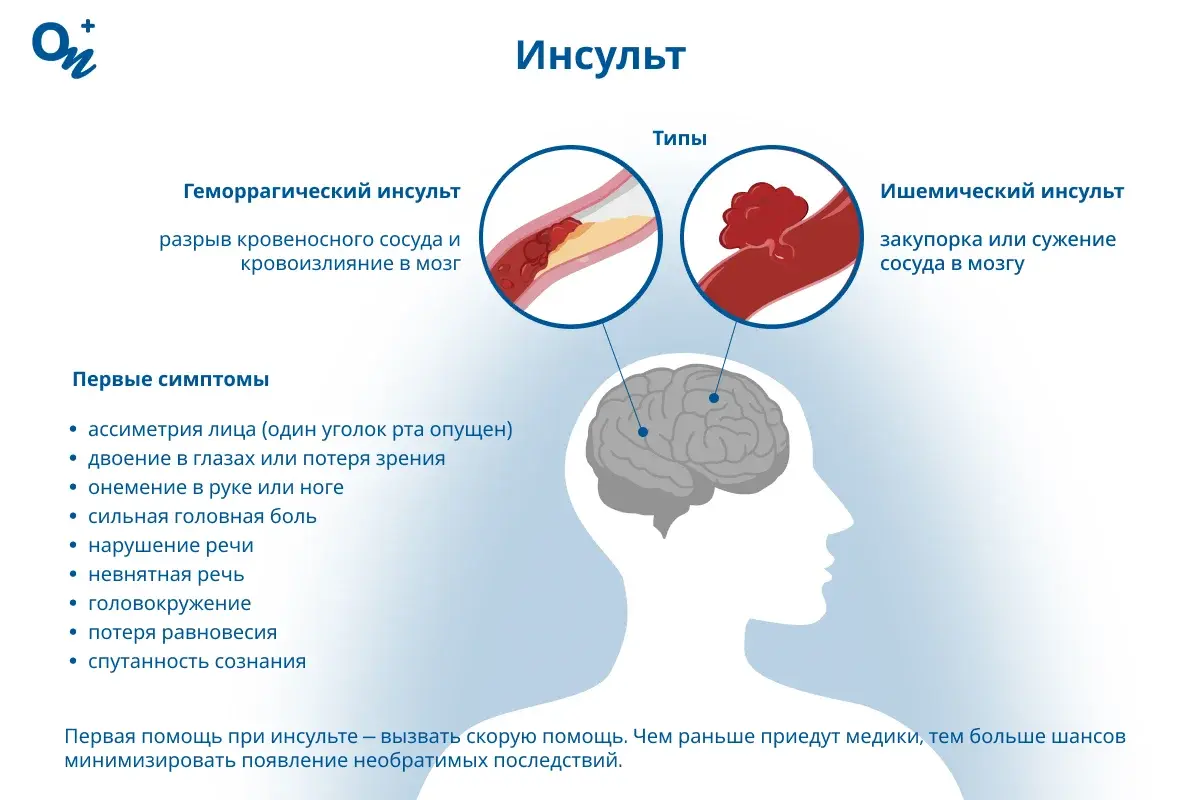 Инсульт