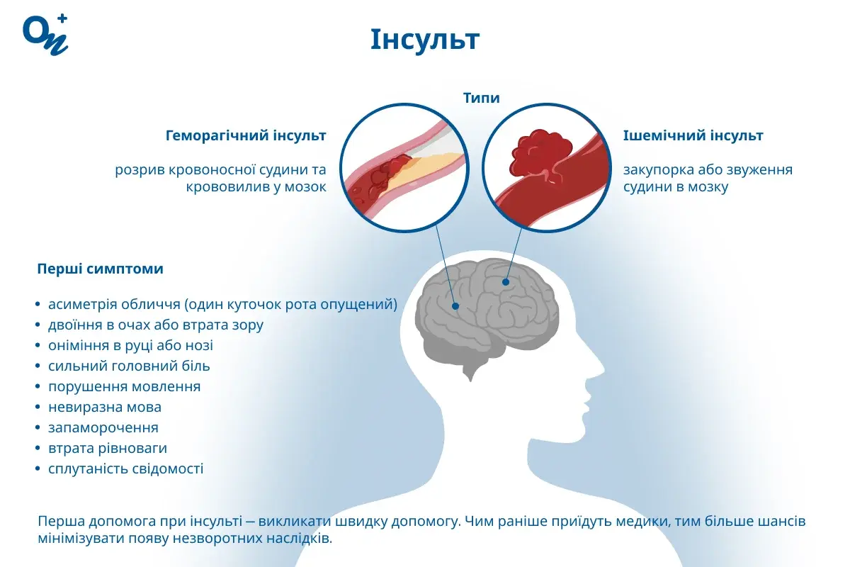 Інсульт