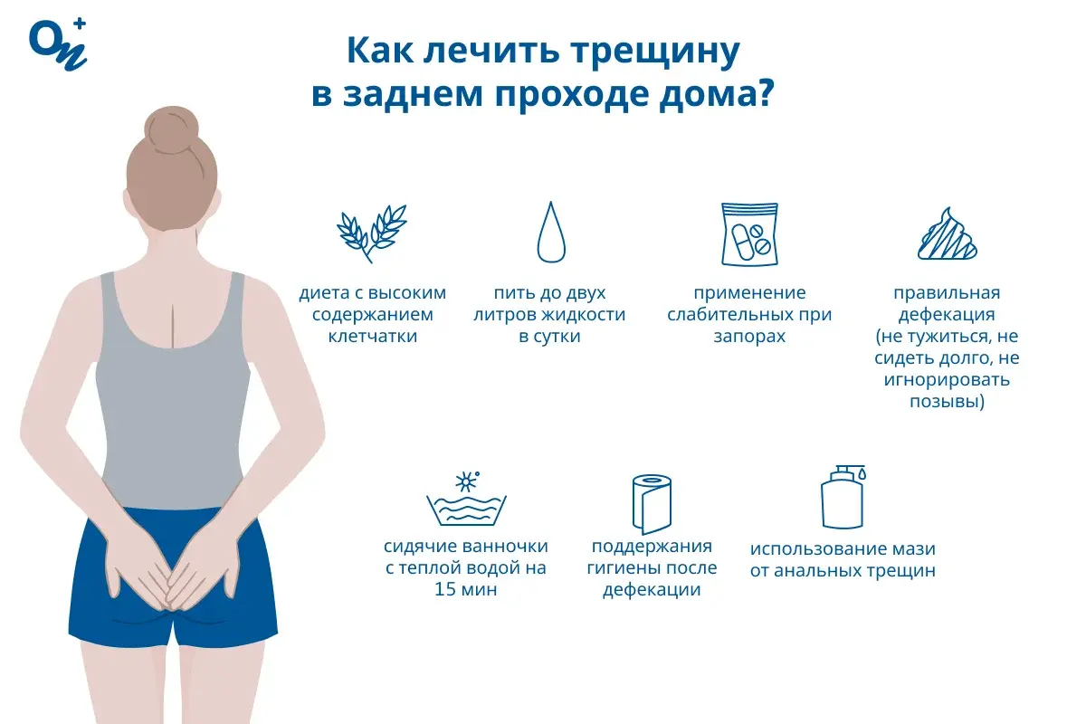 Как лечить трещину в заднем проходе дома?