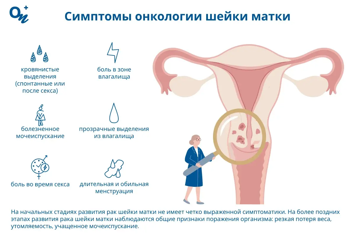 Симптомы онкологии шейки матки