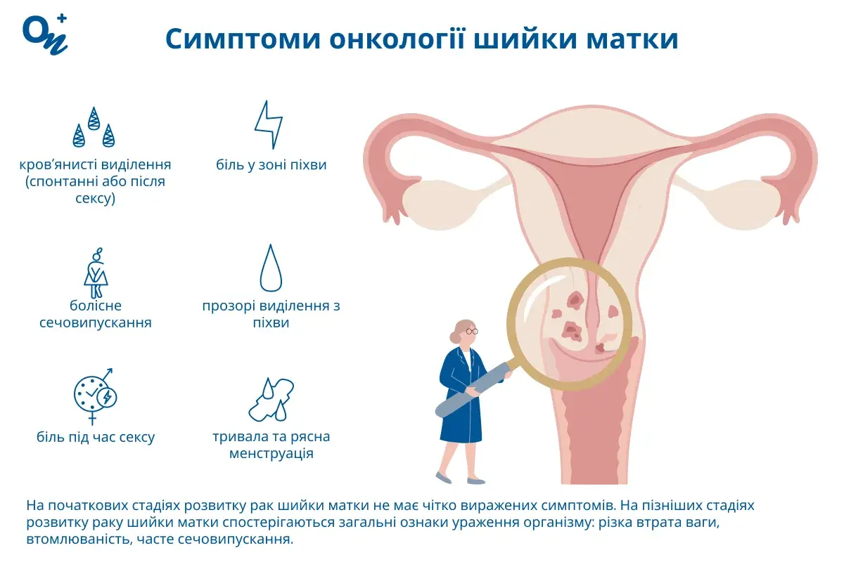 Симптоми онкології шийки матки