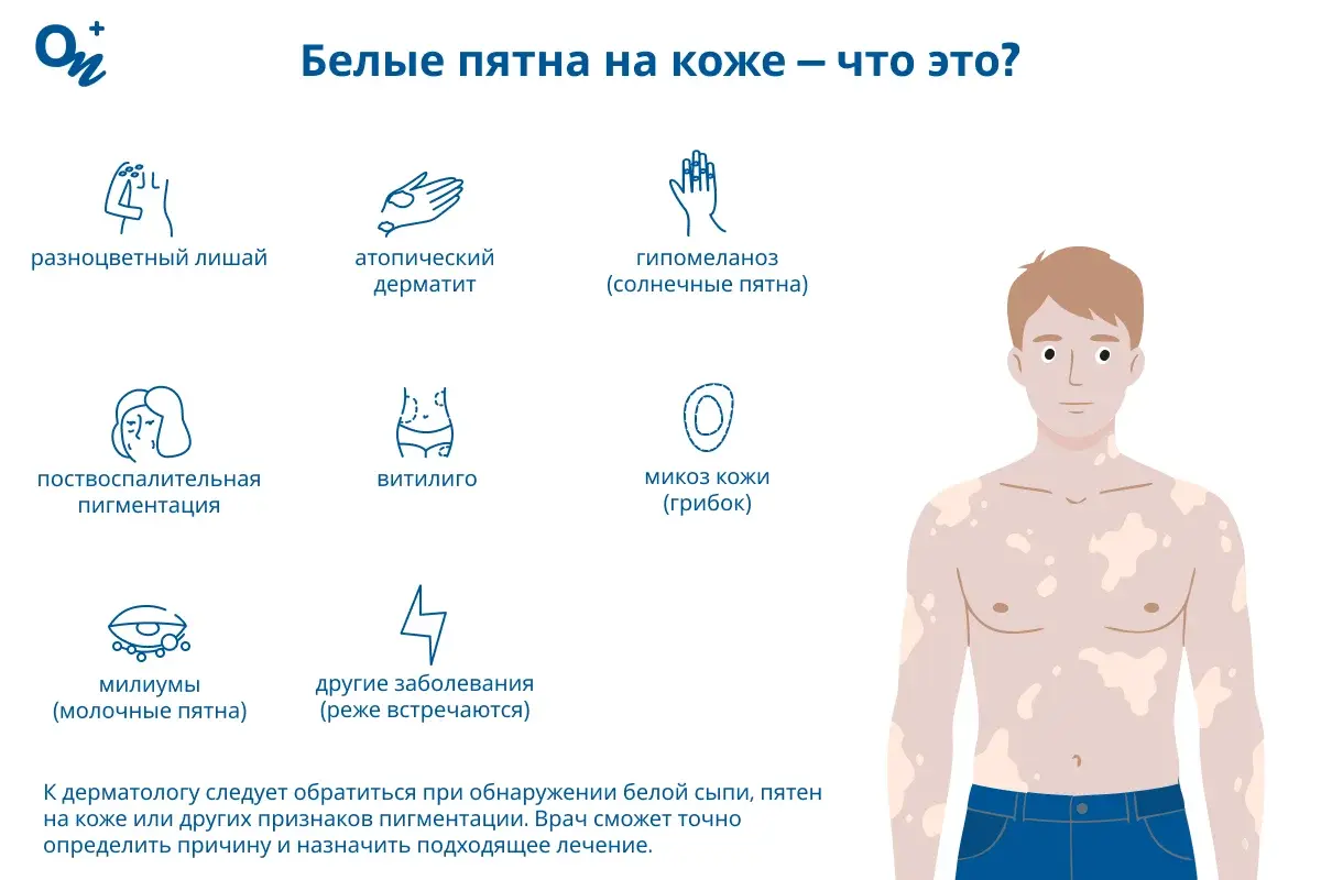 Белые пятна на коже — что это?