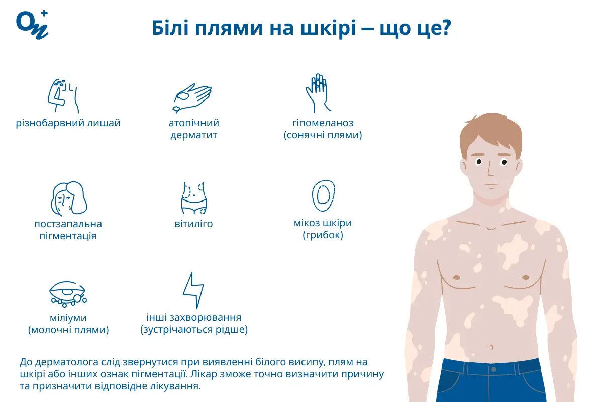 Білі плями на шкірі — що це?