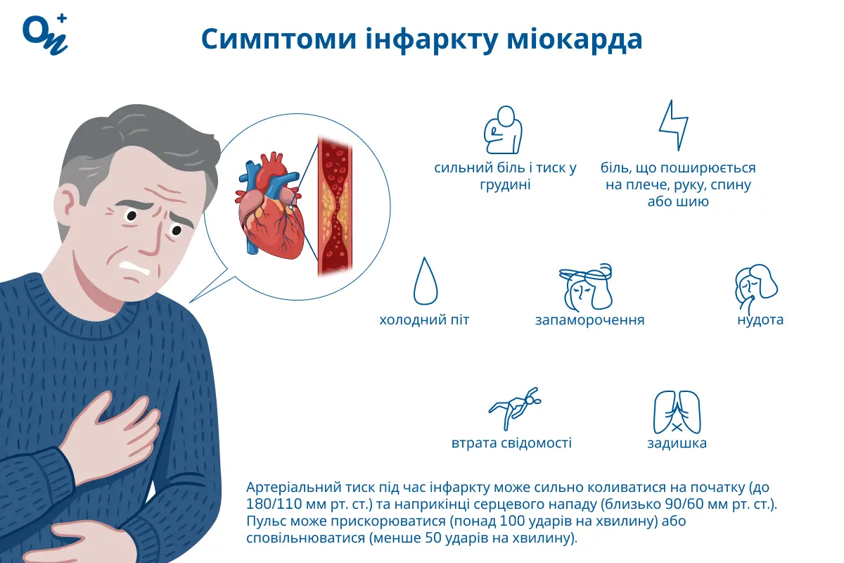 Симптоми інфаркту міокарда