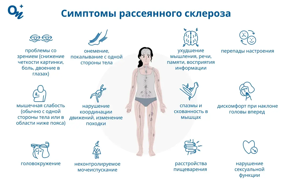 Симптомы рассеянного склероза