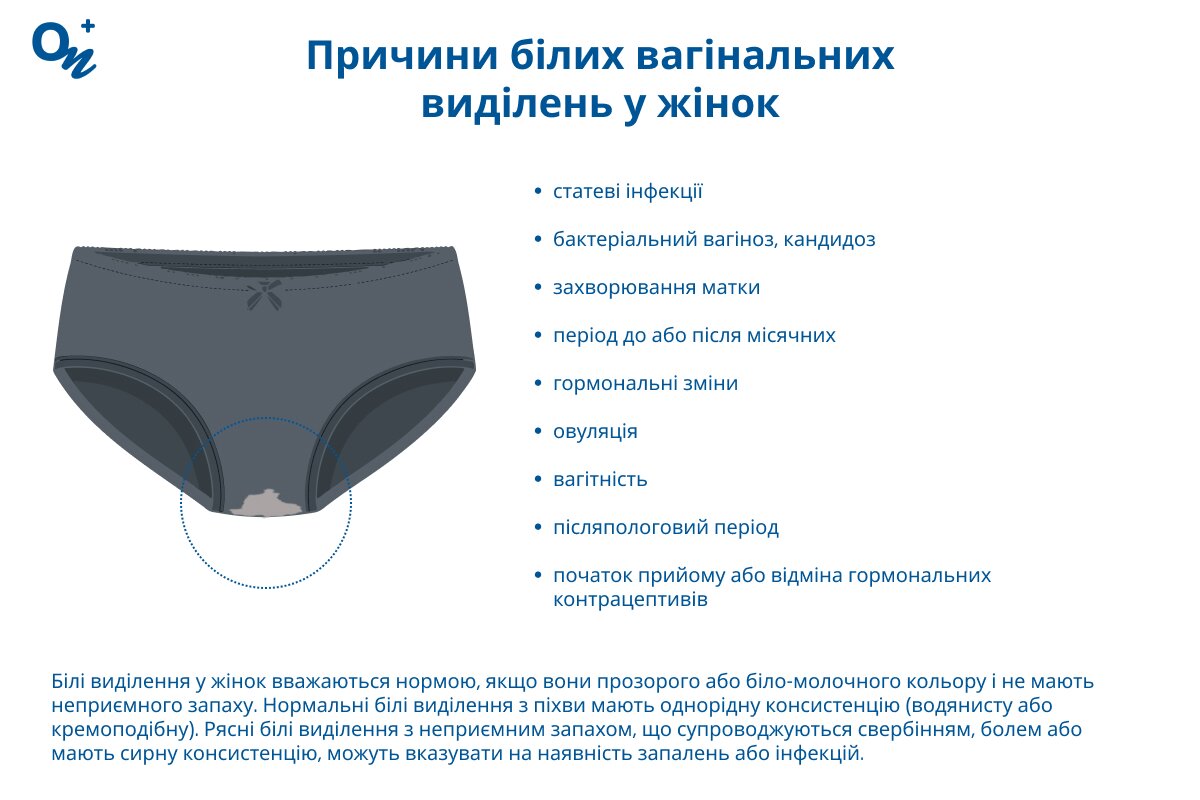 Чому бувають білі вагінальні виділення у жінрок?