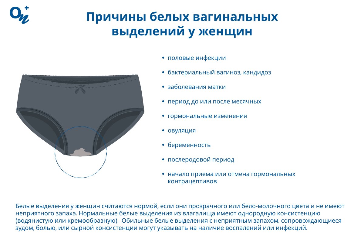 Почему бывают белые вагинальные выделения у женщин?