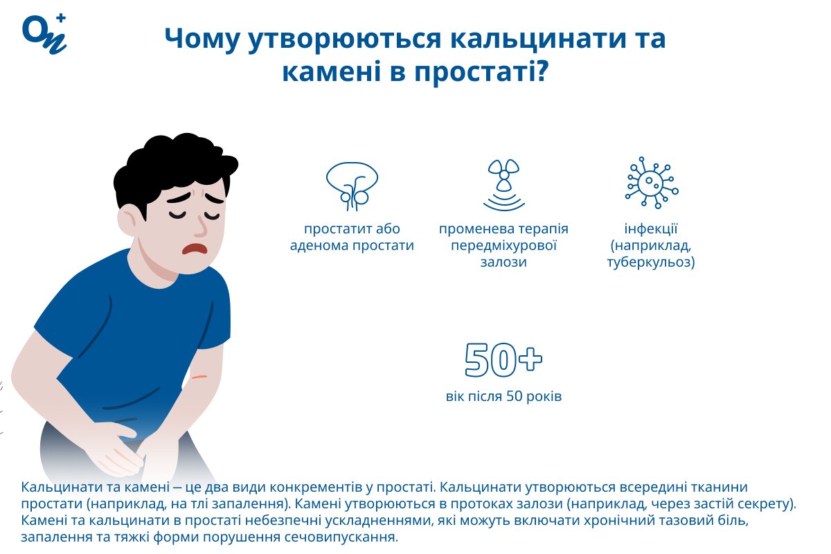 Чому утворюються кальцинати і камені в простаті?