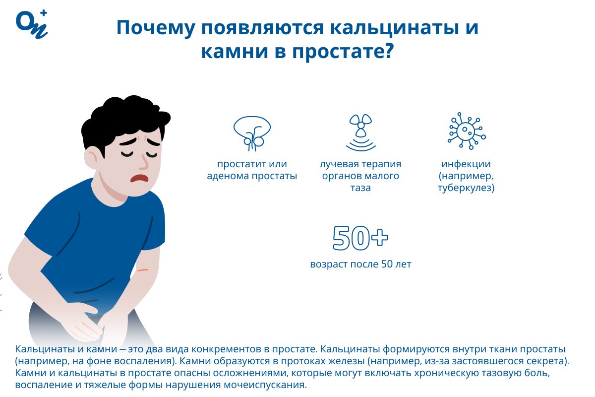Почему образуются кальцинаты и камни в простате?