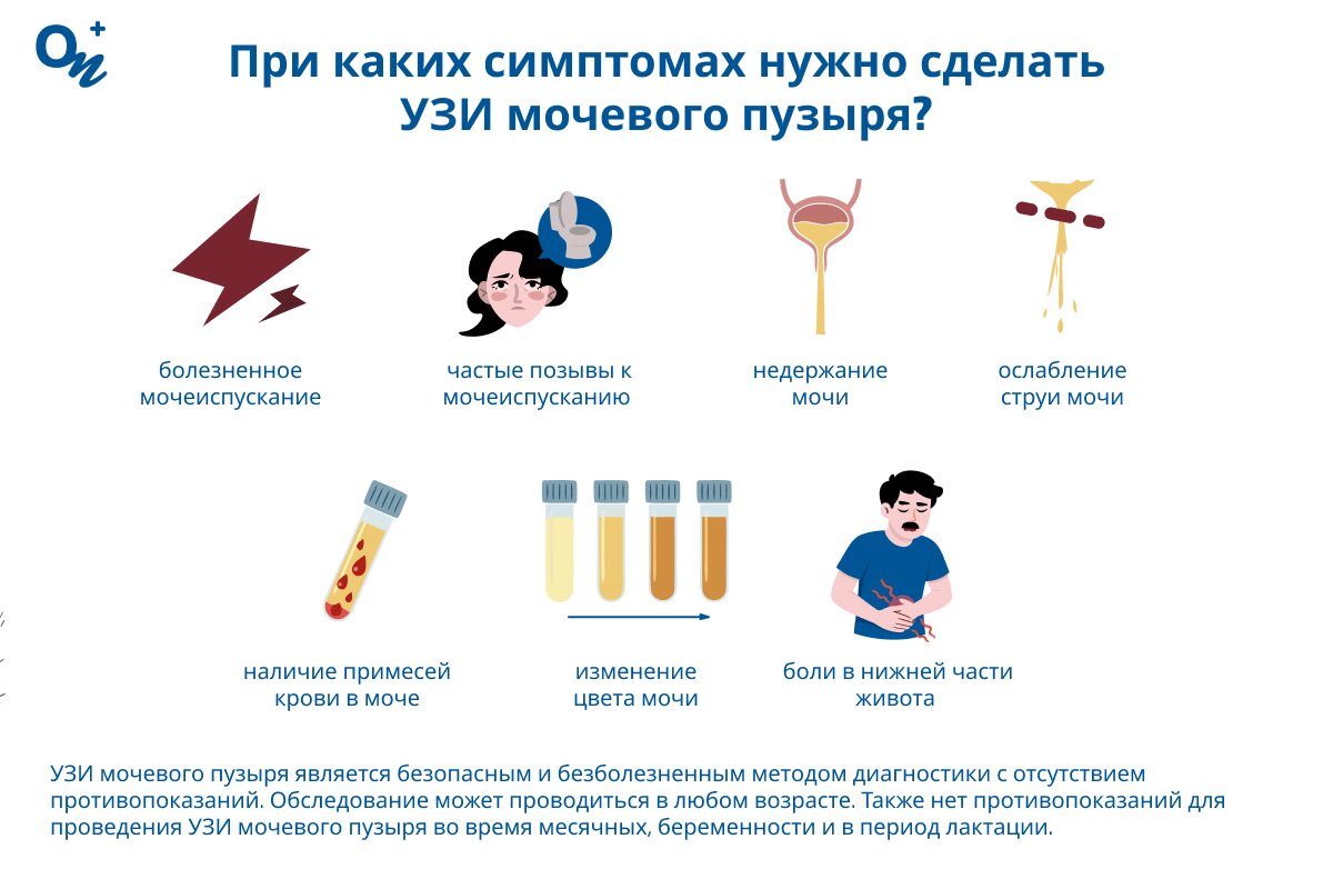 Симптомы, при которых нужно сделать УЗИ мочевого пузыря