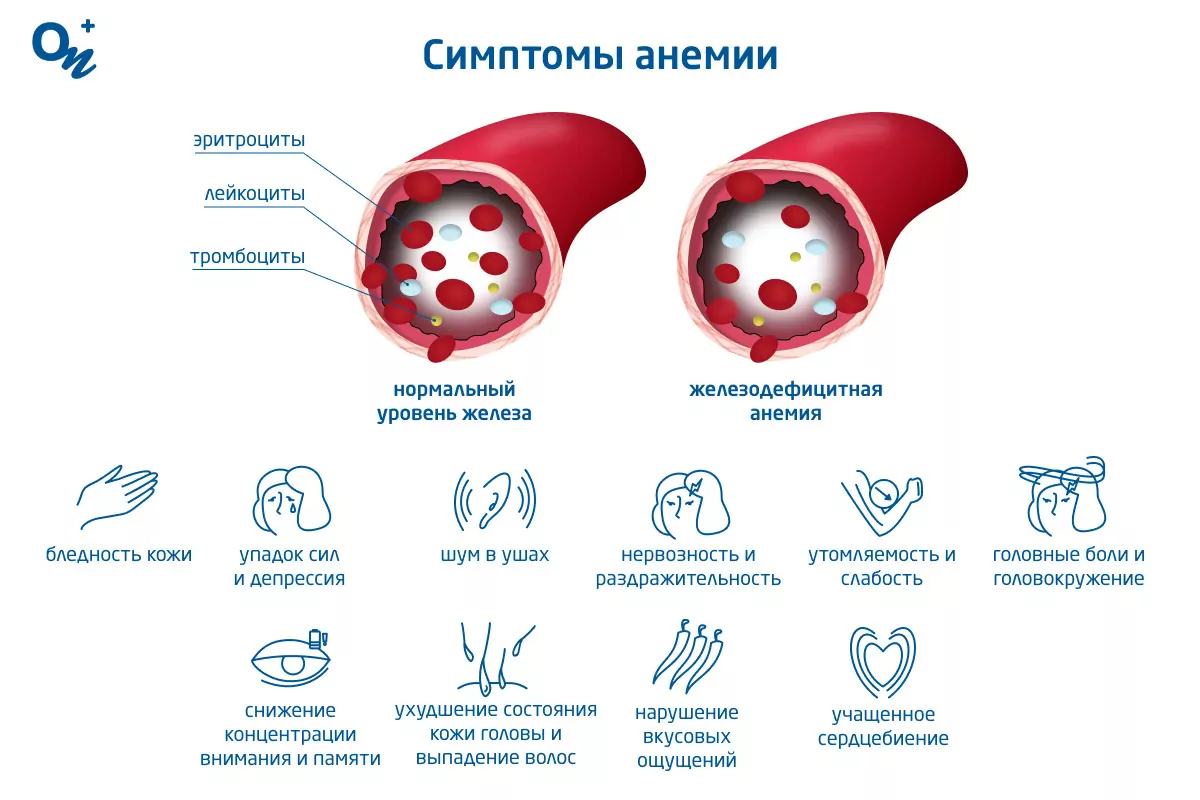 Симптомы и причины нехватки железа в организме