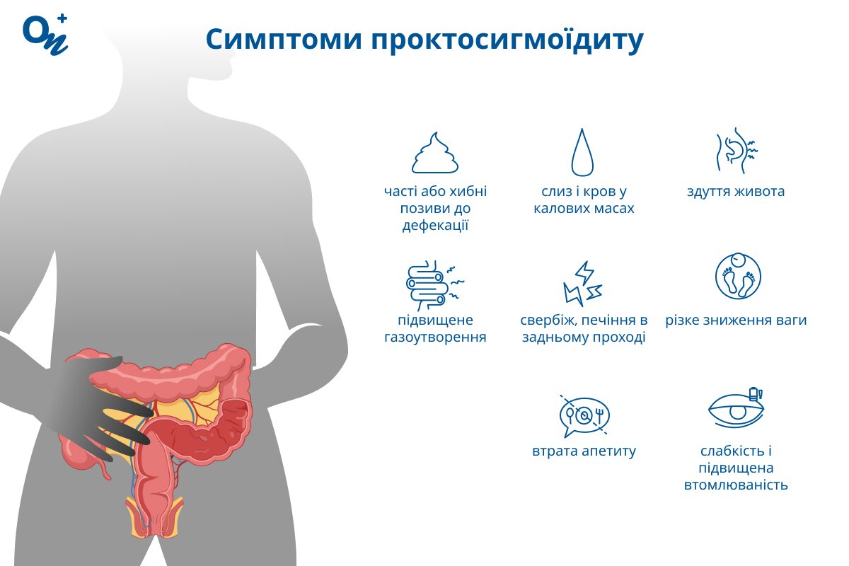 Які симптоми проктосигмоїдиту?