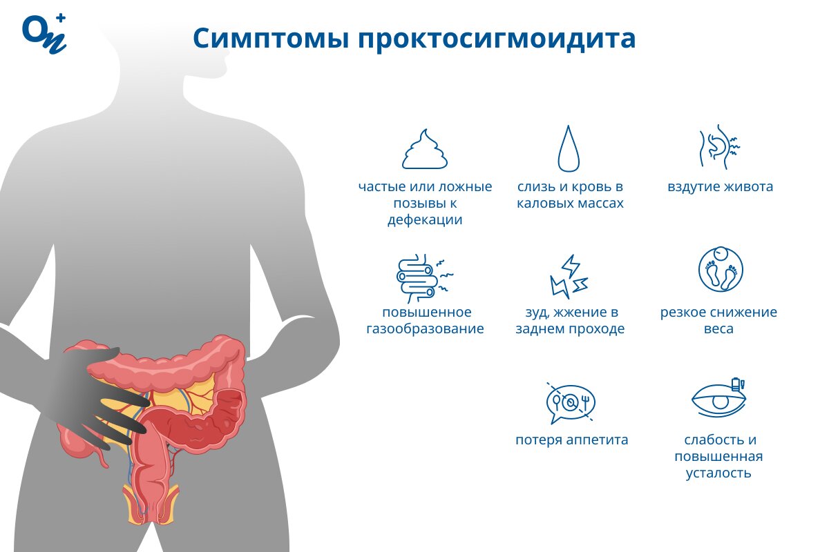 Какие симптомы проктосигмоидита?