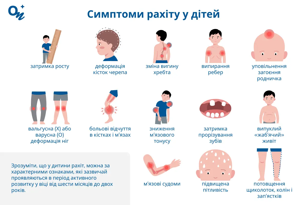 Рахіт