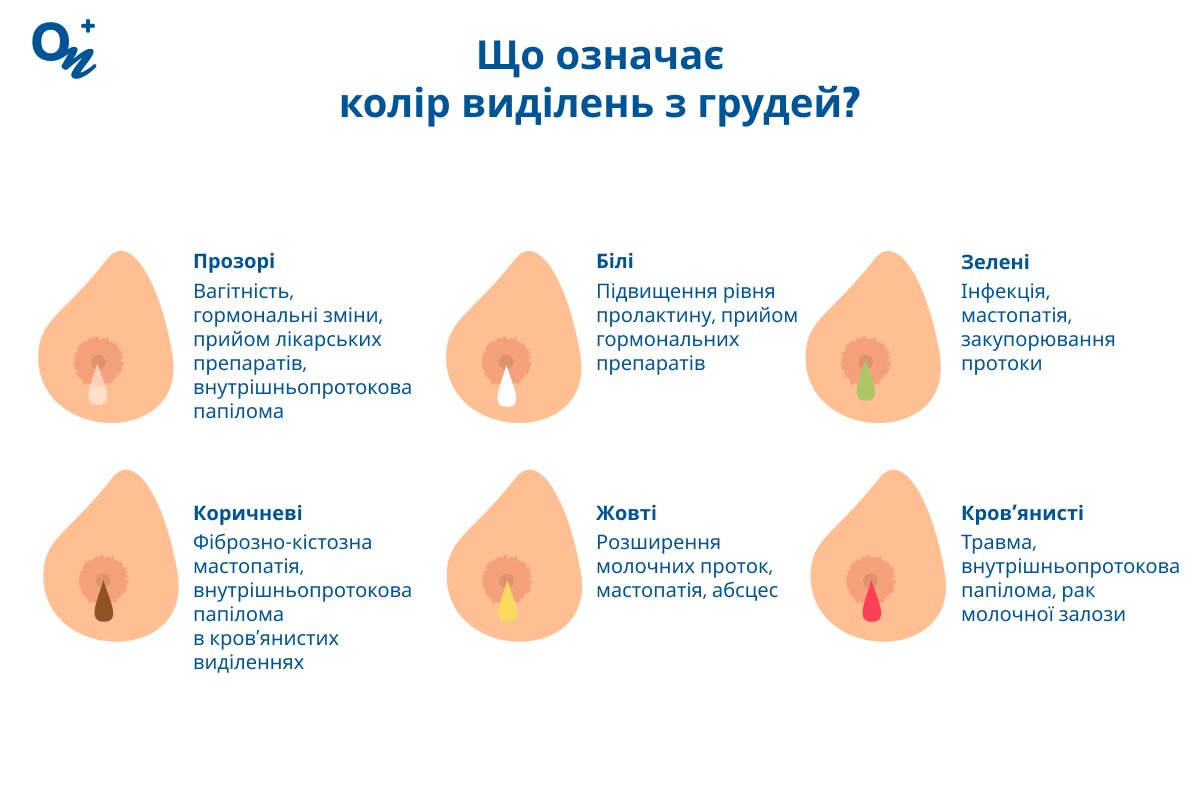 Що означає колір виділень з молочної залози у жінок?