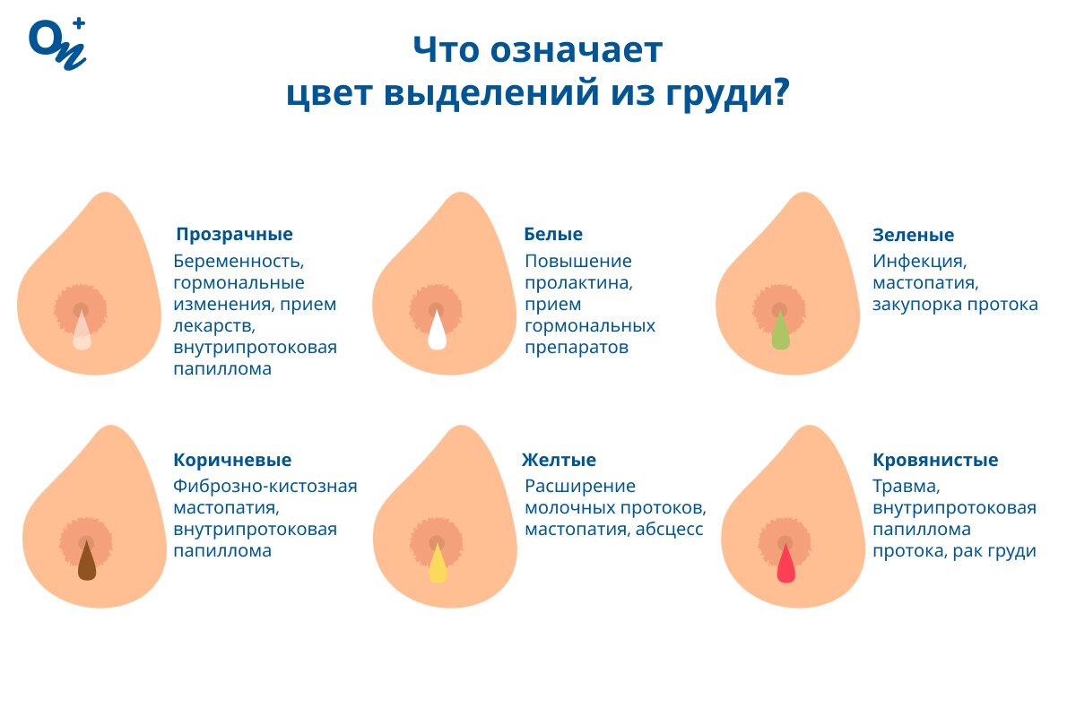 Что означает цвет выделений из молочной железы у женщин?