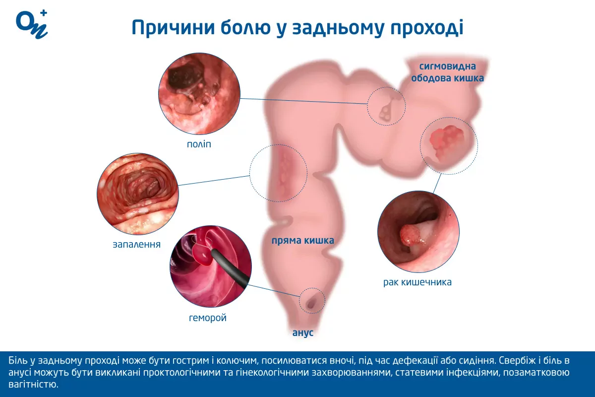 Дефекация — Википедия