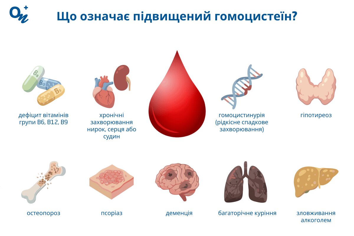 Причини підвищеного гомоцистеїну в крові