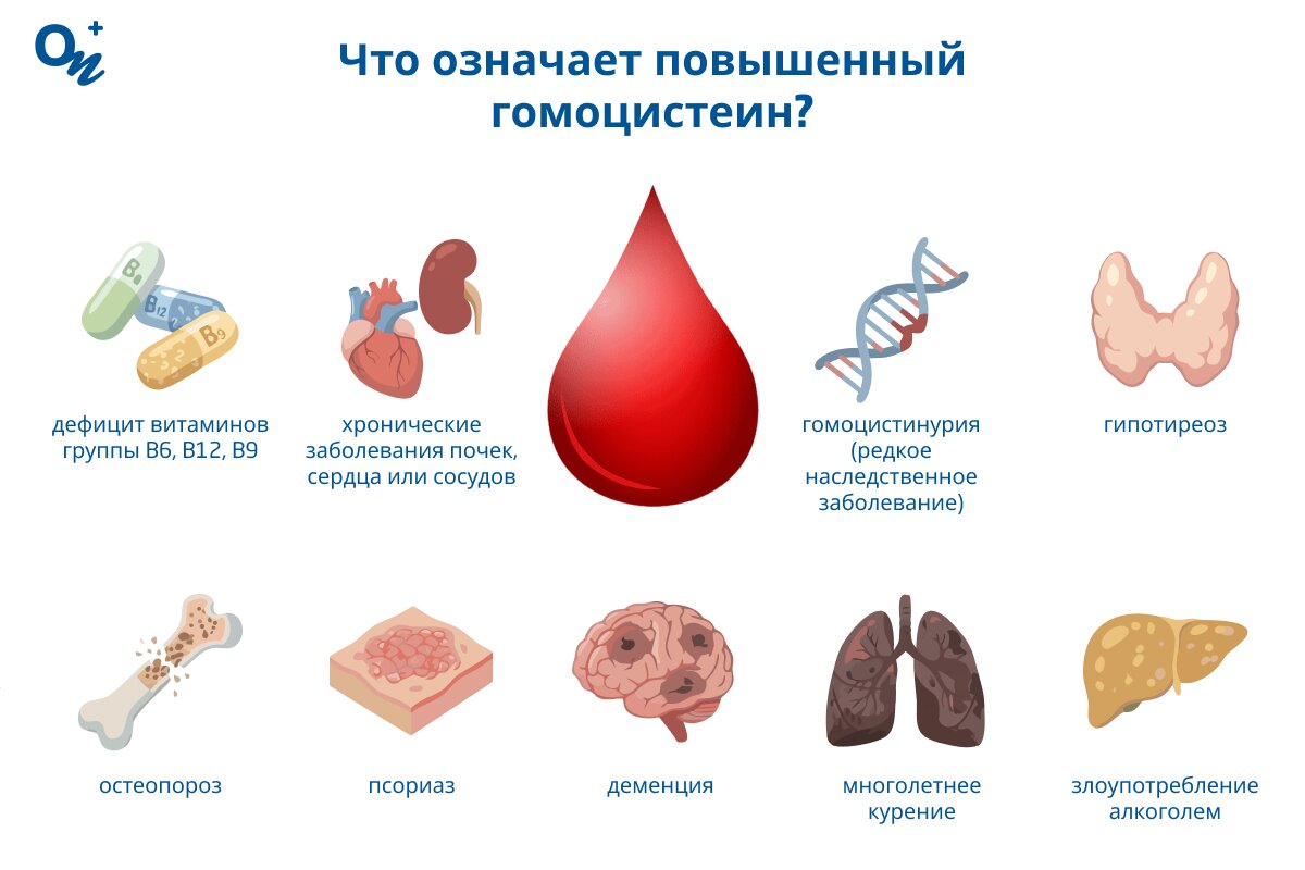 Причины повышенного гомоцистеина в крови