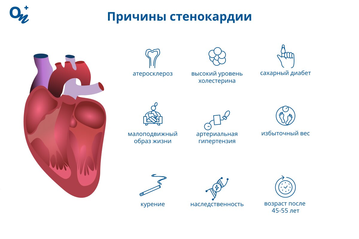 Почему возникает стенокардия?