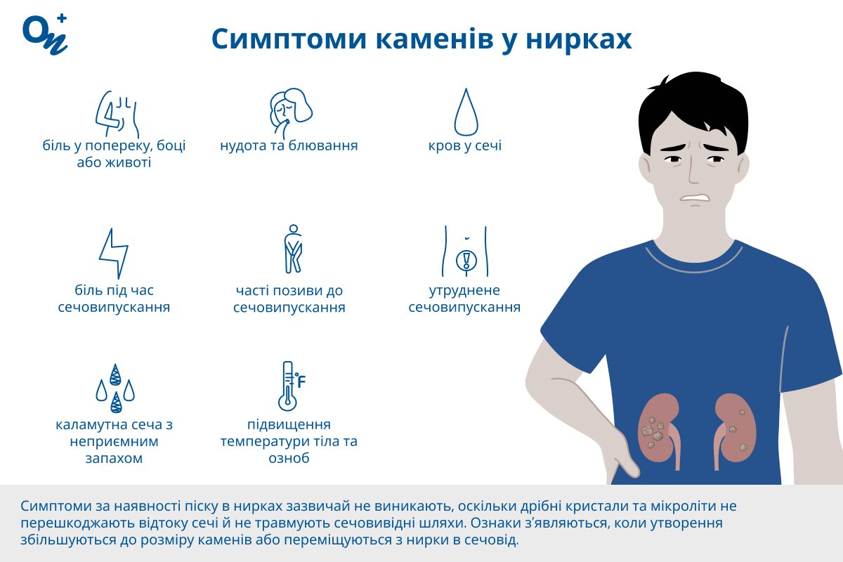 Як зрозуміти, що в нирках є камені?