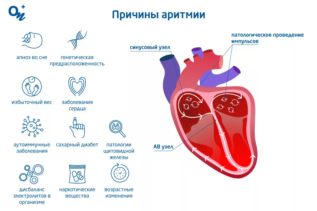 Секс и внезапная сердечная смерть