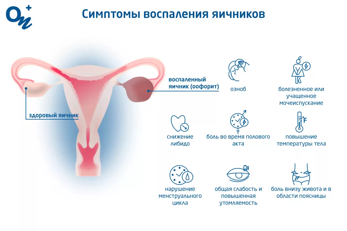 Перевязывать ли яйца????