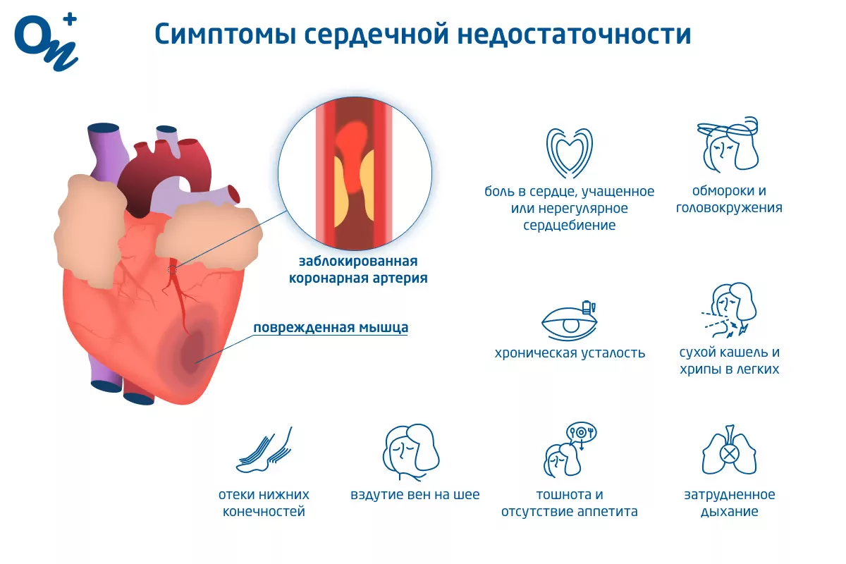 Симптомы и причины сердечной недостаточности — блог медицинского центра ОН  Клиник