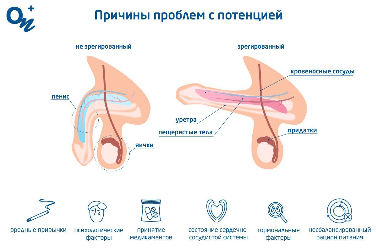 Эрекция — Википедия