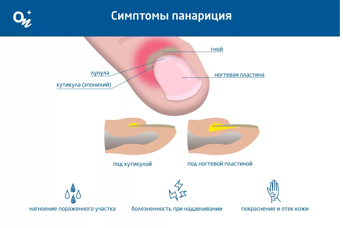 Нарушение свертываемости крови