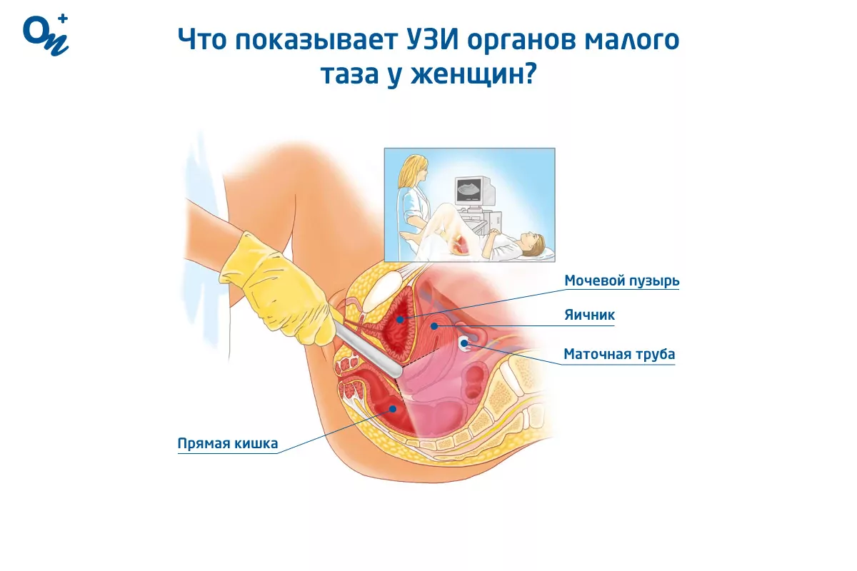 УЗИ при гинекологических заболеваниях (трансвагинальное)