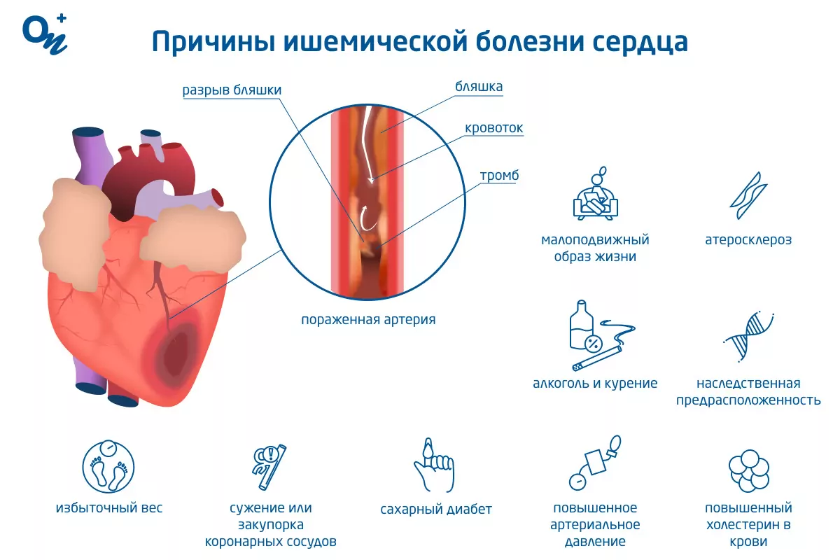 Страхи после инфаркта миокарда