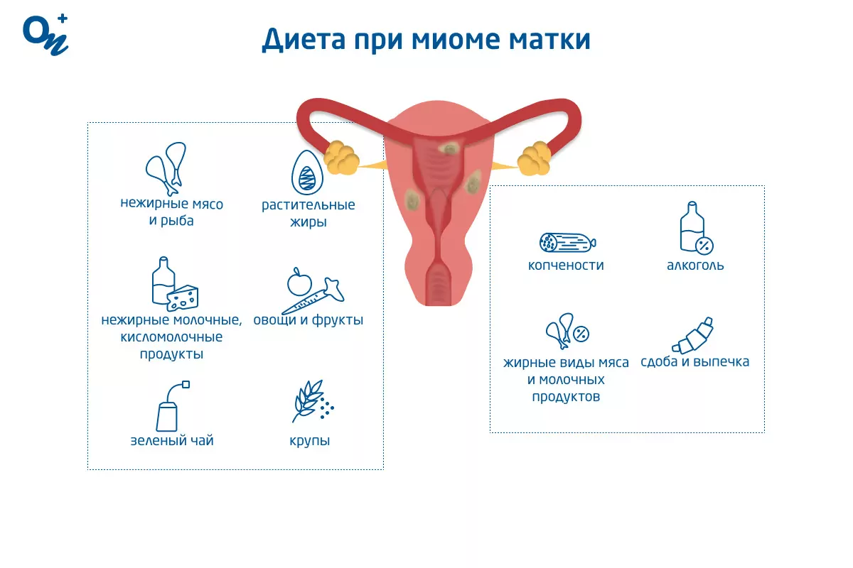 Что нельзя делать при миоме матки? - Хирург К. В. Пучков