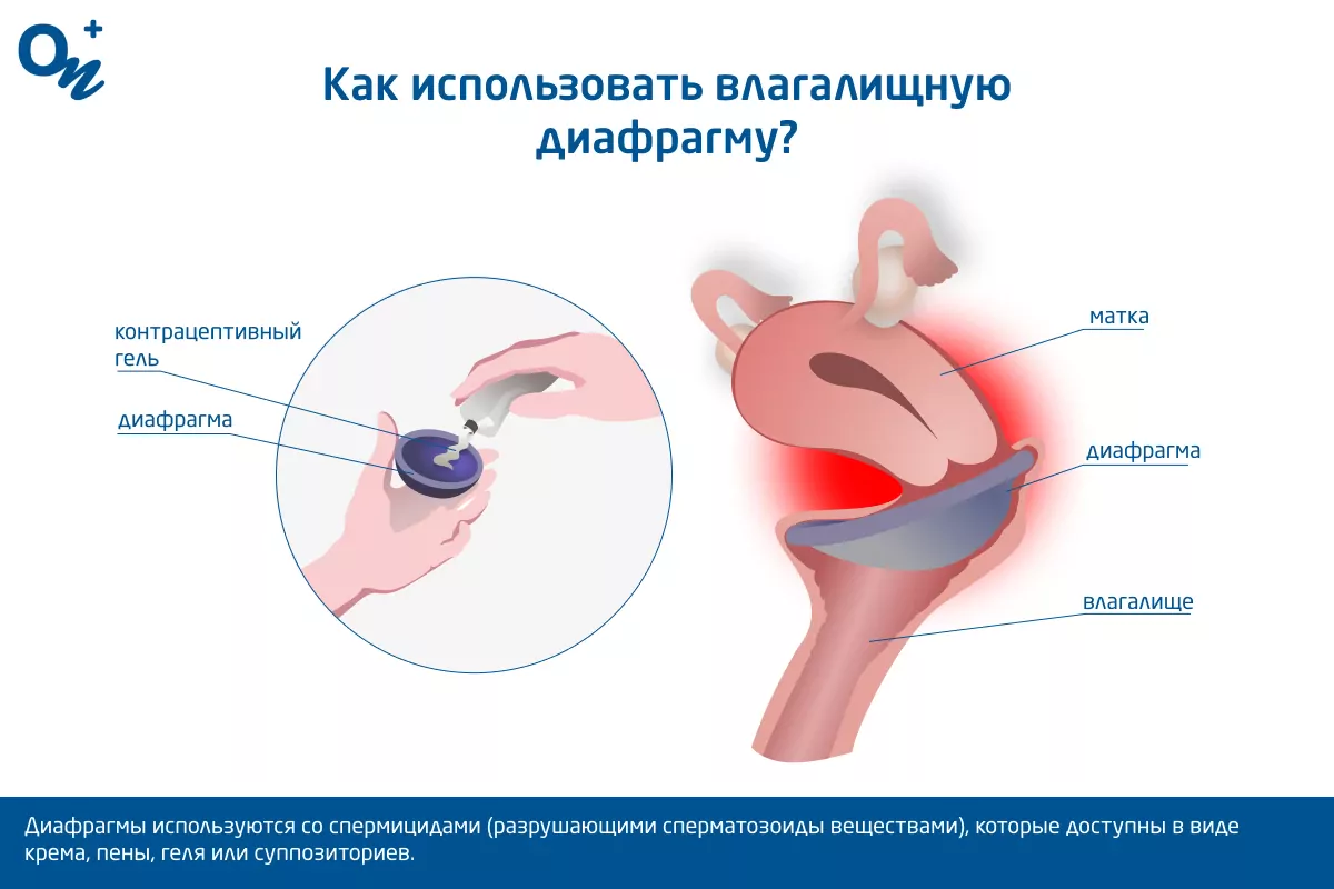 Парни, тут вопрос появился - Page 5 - Таверна - anfillada.ru